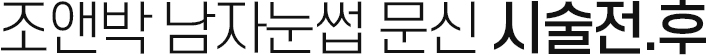 조앤박 남자눈썹 문신 시술전.후